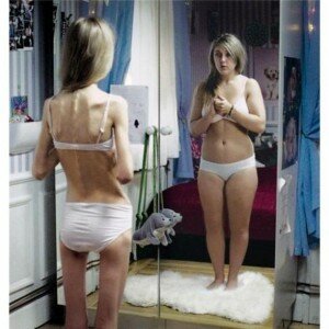 anorexicagorda